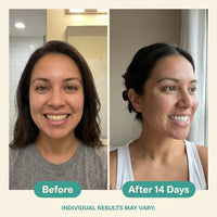Oralhoe Coconut Oil Whitening Strips