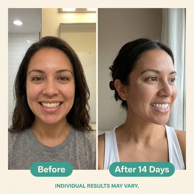 Oralhoe Coconut Oil Whitening Strips