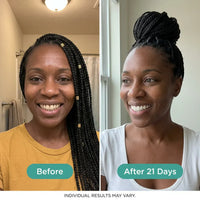 Oralhoe Coconut Oil Whitening Strips