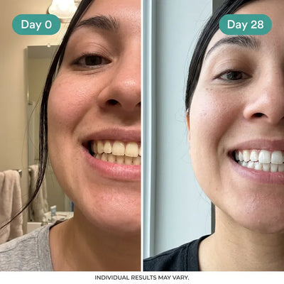 Oralhoe Coconut Oil Whitening Strips
