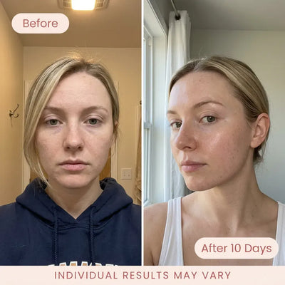 Bio-Collagen Deep Mask 3
